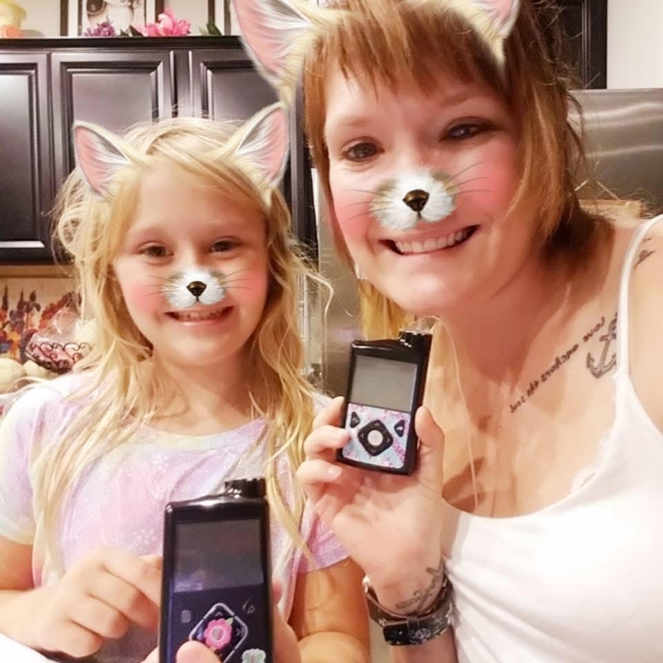 Alex with Her Type 1 Diabetes Technology