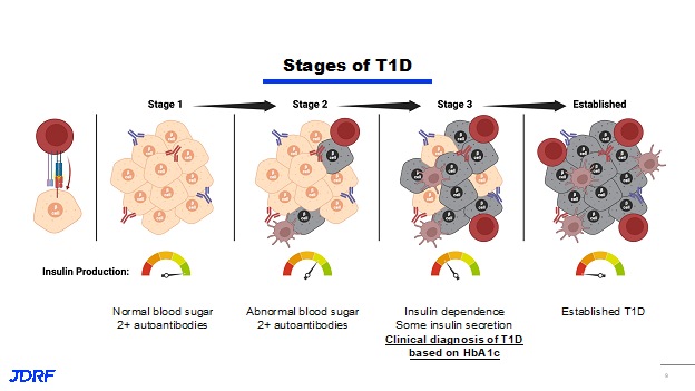 Stages of T1D