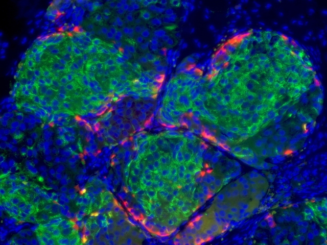 Breakthrough T1D-Funded Research Leads to Beta Cell Replacement Breakthrough