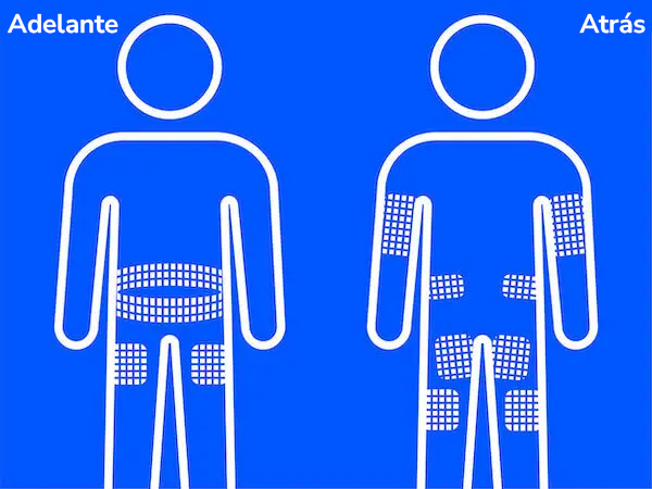 Lugares de inyección